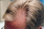 Male Hair example 5 before